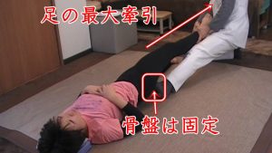 膝を曲げた状態で物足りない時は、術者と患者の膝を同時に伸ばしていき骨盤を固定して体幹がズレないように、足首から最大の力で足一本根こそぎ牽引します。骨盤を固定することでしびれが出にくい状態になっています。