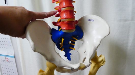 腰部椎間板ヘルニア背骨模型